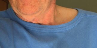 Penyakit Jantung Jadi Penyebab Utama Kematian di Indonesia