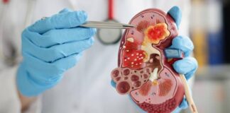 157 Anak di Indonesia Meninggal Dunia Akibat Gagal Ginjal Akut