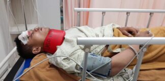 Alami Kecelakaan Kerja, Pekerja Masjid Agung Batam Alami Cedera di Bagian Kepala