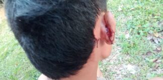 Penjual Tisu di Batam Viral Kepala Bocor Setelah Dianiaya Oknum Dinsos dan Satpol PP