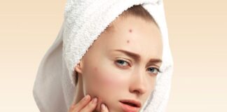 Ingin Kulit Wajah Sehat? Hindari 3 Jenis Makanan Penyebab Jerawat